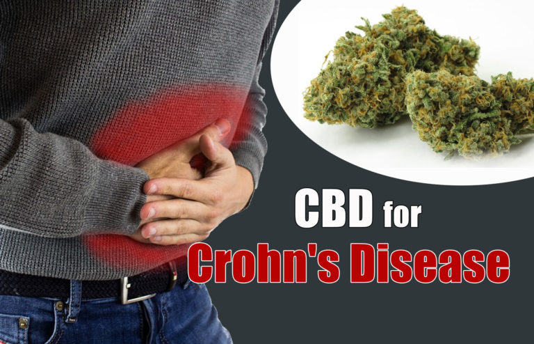 CBD for Crohn’s Disease